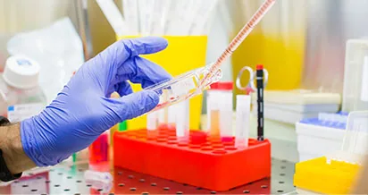 Peptide bei Diabetes